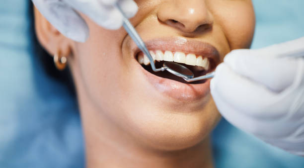 Best Weekend Emergency Dentist in Cherryland, CA